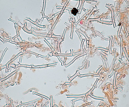 Hyphoderma setigerum